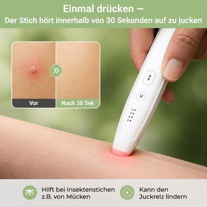 Insektenstich-Stift zur Juckreizlinderung – Chemiefreie Wärmetherapie – USB-Aufladbar
